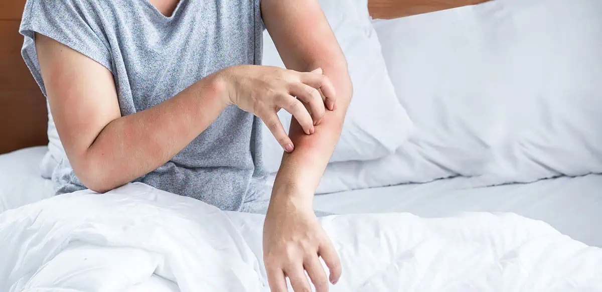 allergic reaction symptoms patient first